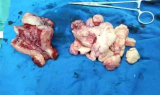 年轻的姨妈7 年轻的姨妈7